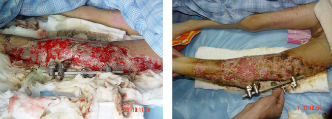 首页- 平博pinnacle888公司官网