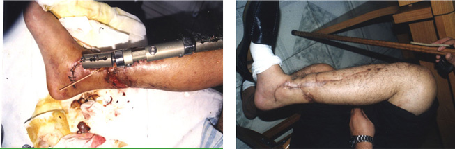 首页- 平博pinnacle888公司官网